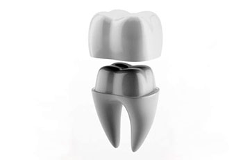 Prosthodontics crowns